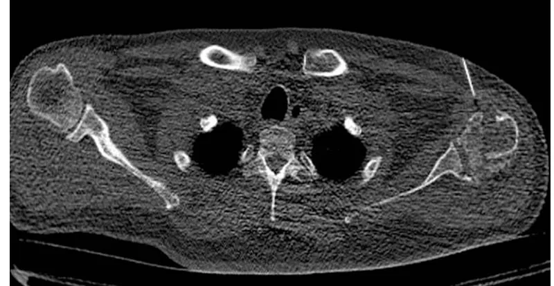 Radiological