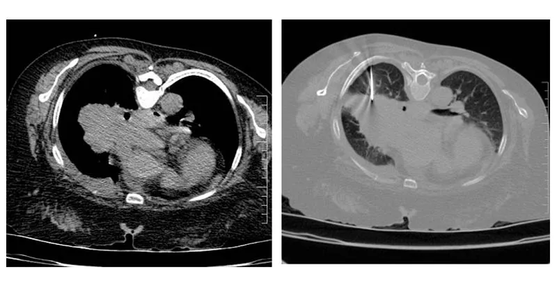 Radiological