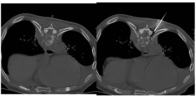 Radiological