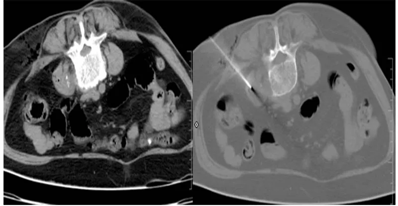 Radiological