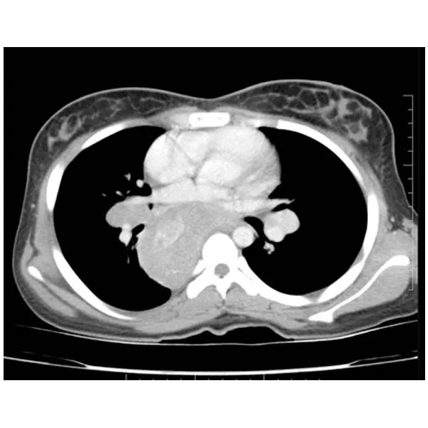 Radiological