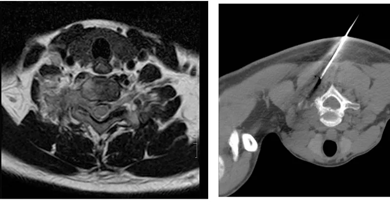 Radiological