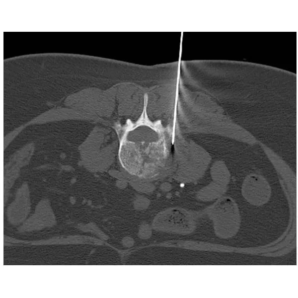 Radiological