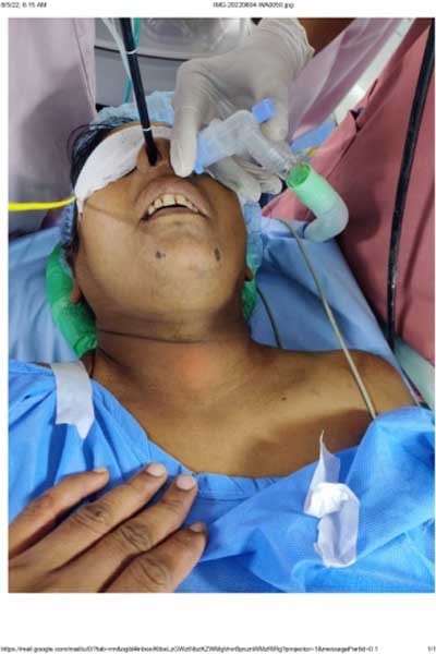 bronchoscopy_2.webp